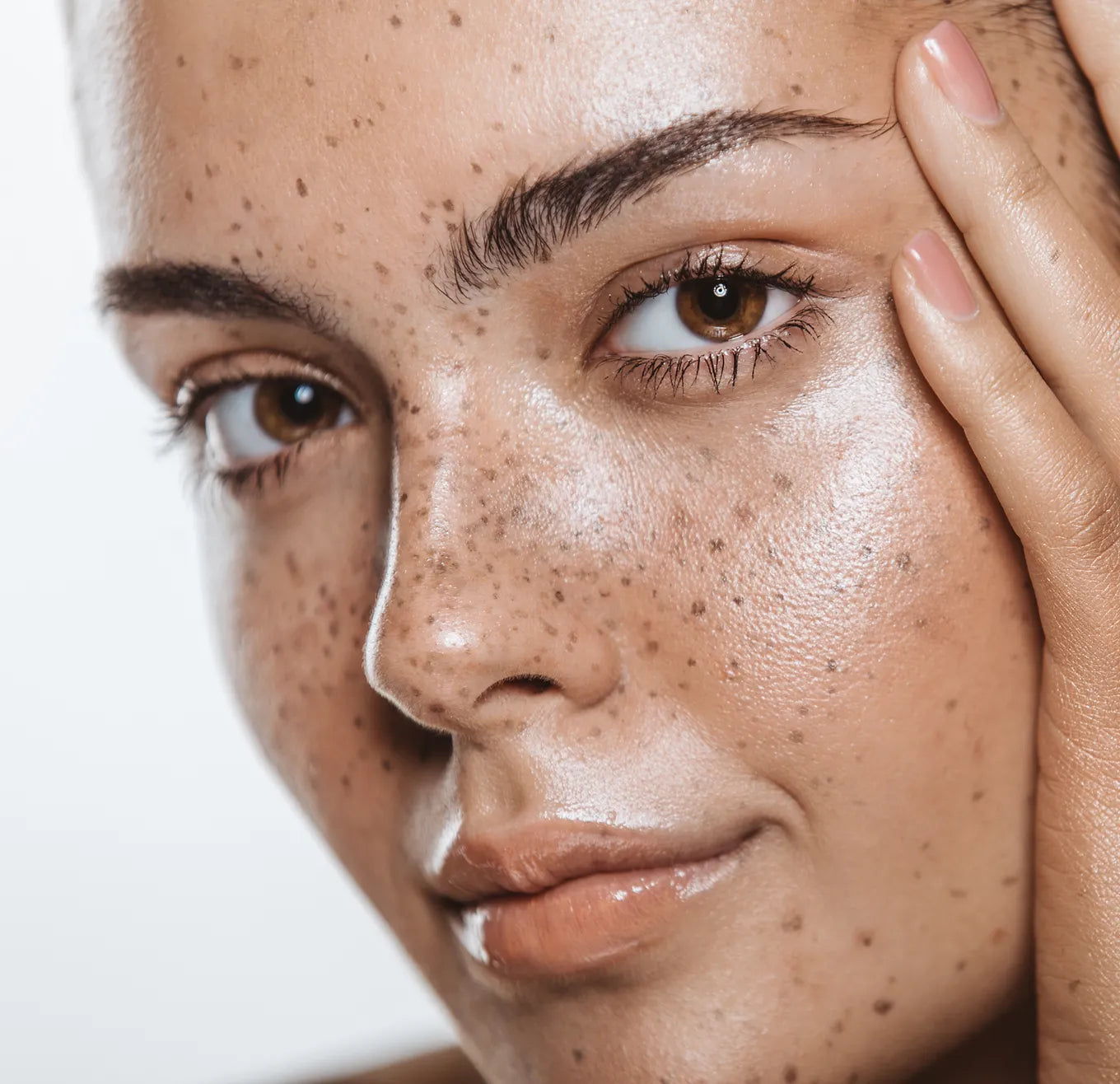 5 different types of Acne