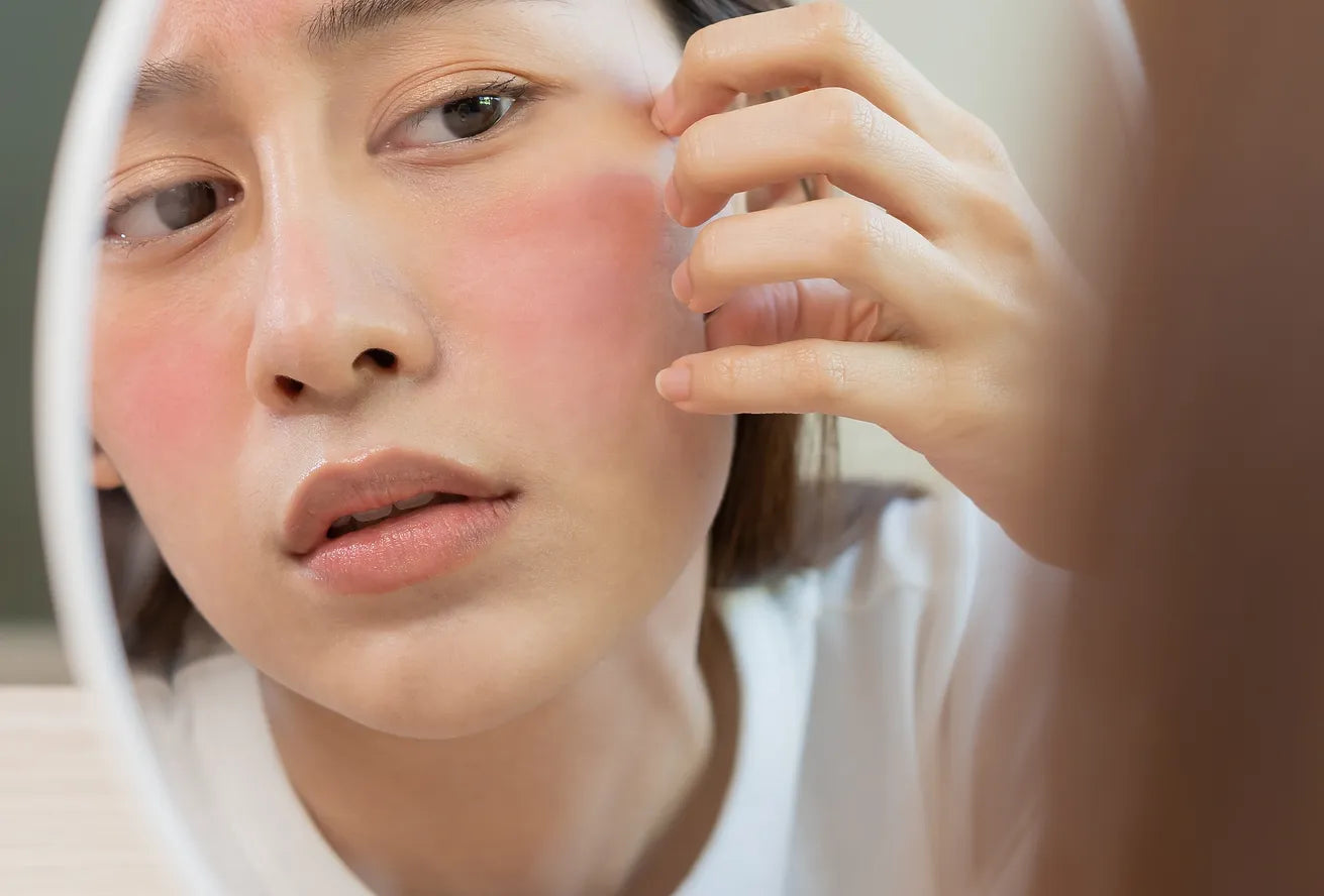 6 Signs you have Sensitive Skin