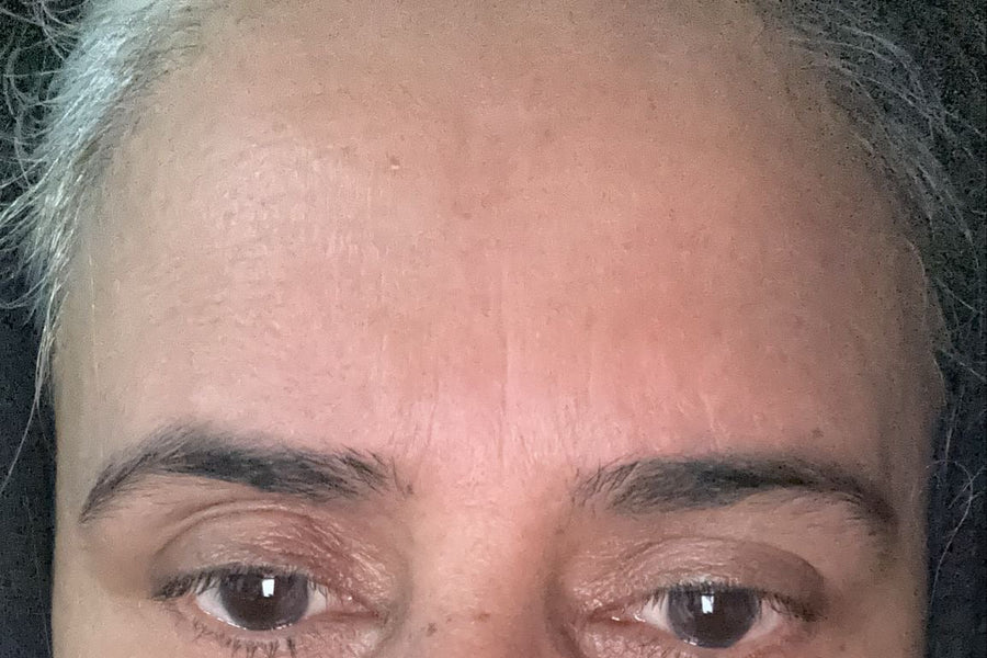 Customer skin after using Exosome Serum