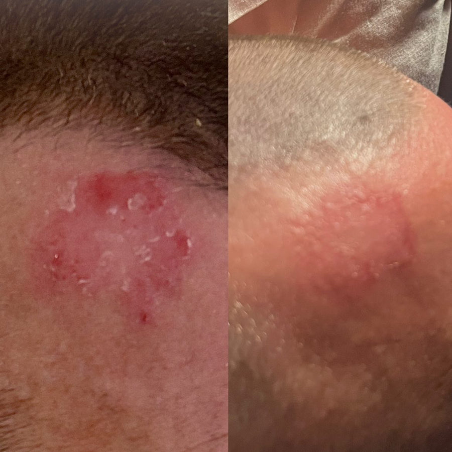 Customer before and after using Night Face Oil