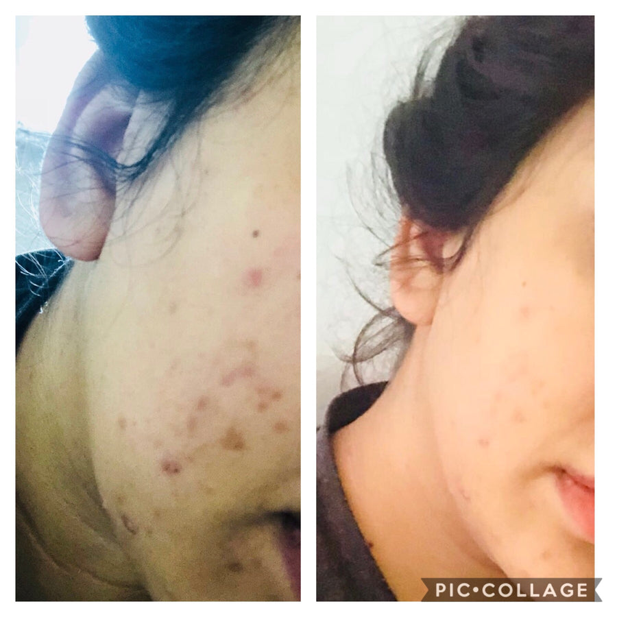 Customer before and after using Night Face Oil