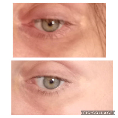 Solo Skin Eye Oil lifestyle