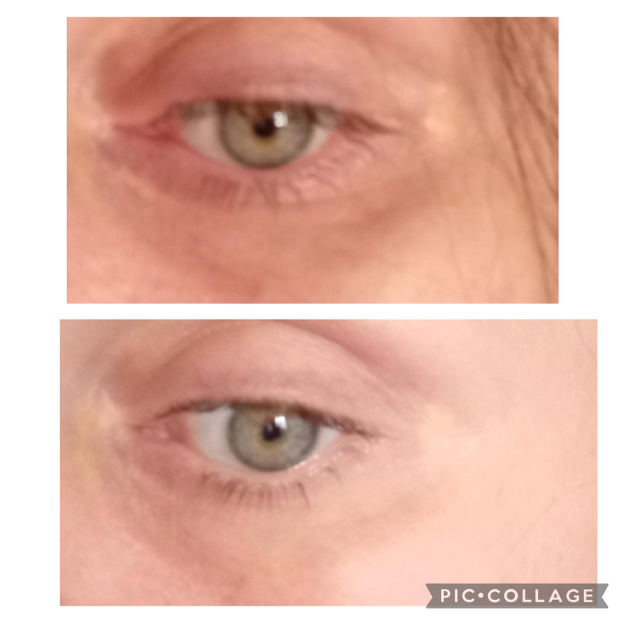 Customer before and after result