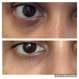 Dark Circles Under Eye Oil