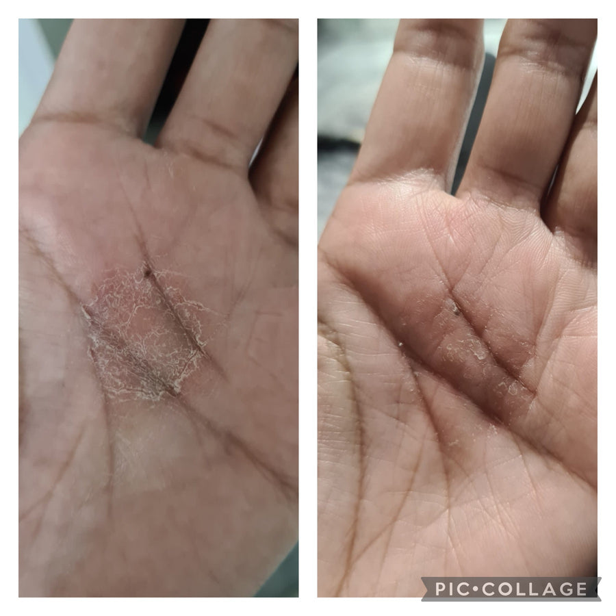 Customer before and after using Night Face Oil