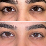 Dark Circles Under Eye Oil