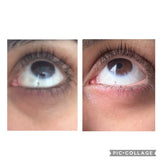 Dark Circles Under Eye Oil