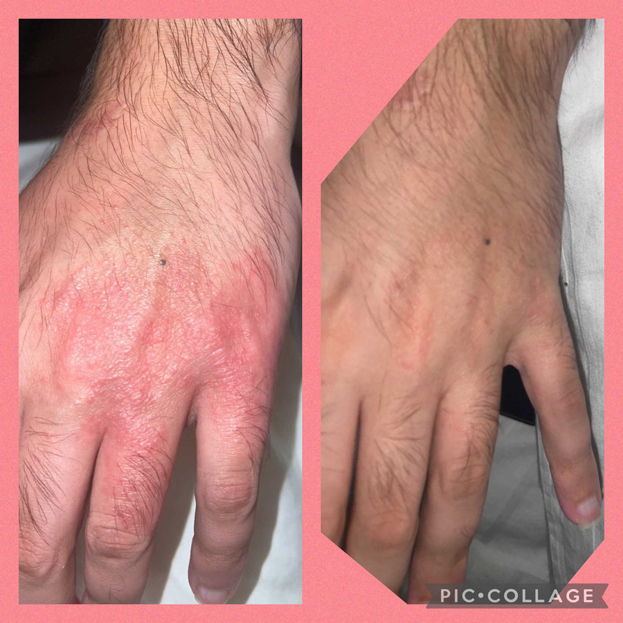 Customer before and after using Night Face Oil