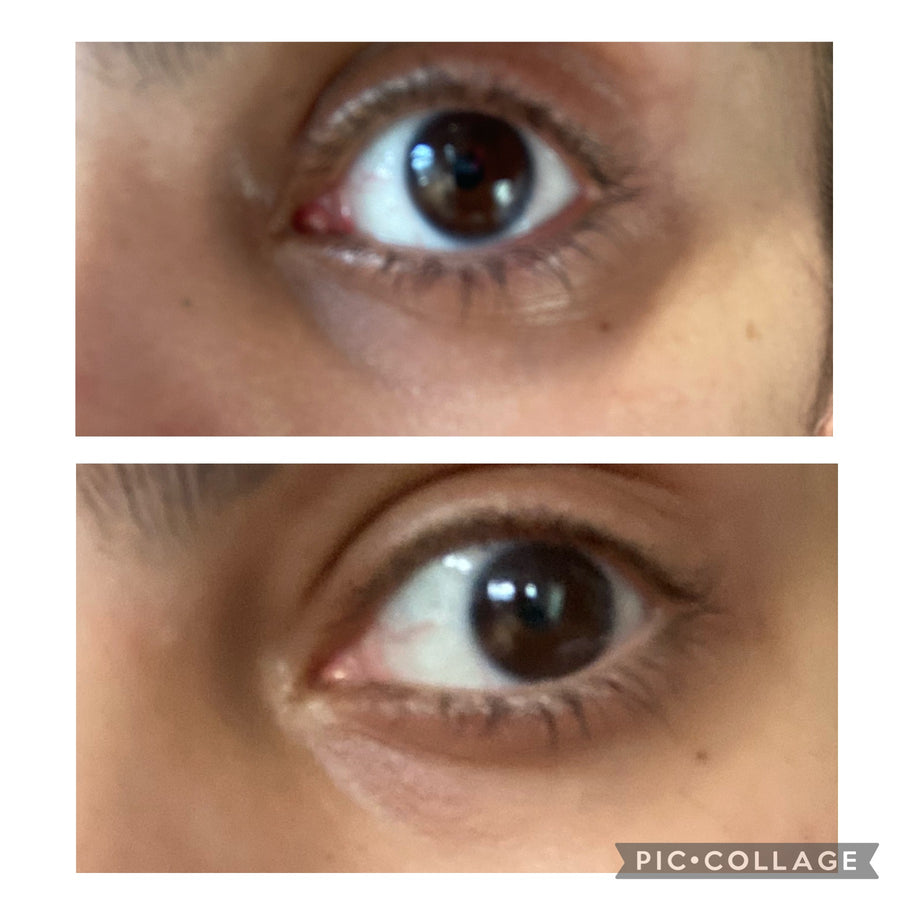 Customer before and after result