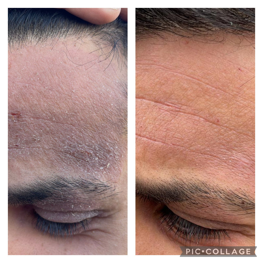 Customer before and after using Night Face Oil