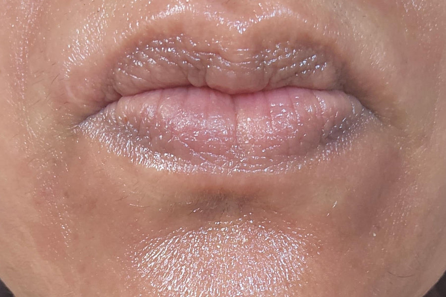 Customer skin after using Bakuchiol Oil