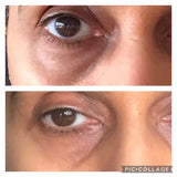 Dark Circles Under Eye Oil